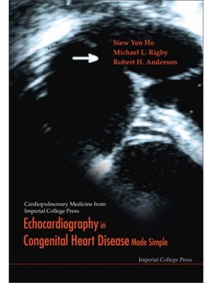 预订不退不换Echocardiography In Congenital Heart Disease Made Simple