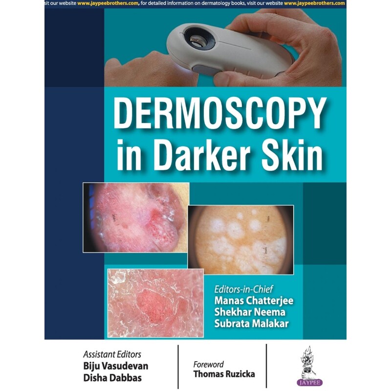 按需印刷不退不换Dermoscopy in Darker Skin[9789386322678]