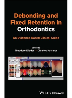 预订Debonding and Fixed Retention in Orthodontics: