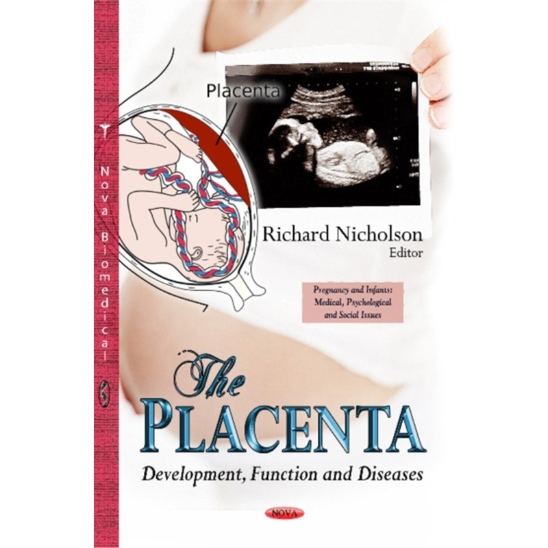 预订，预计下单后4-6周左右发货