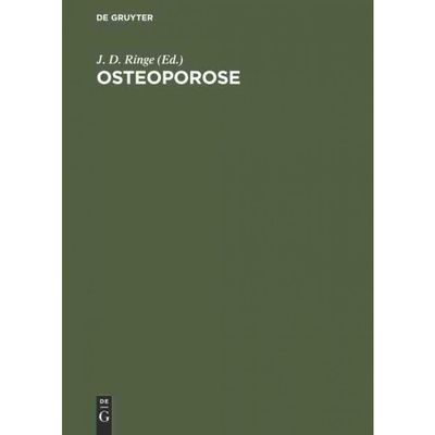 按需印刷不退不换DEG Osteoporose[9783110120288]