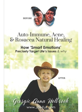 预订Auto-Immune, Acne, & Rosacea Natural Healing - How 'Smart Emotions' Precisely Target Life's Issues &