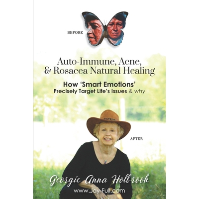 预订Auto-Immune, Acne, & Rosacea Natural Healing - How 'Smart Emotions' Precisely Target Life's Issues &