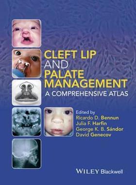 预订Cleft Lip and Palate Management