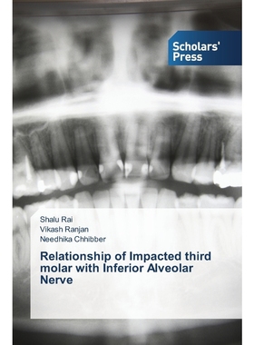 按需印刷Relationship of Impacted third molar with Inferior Alveolar Nerve[9783639767285]