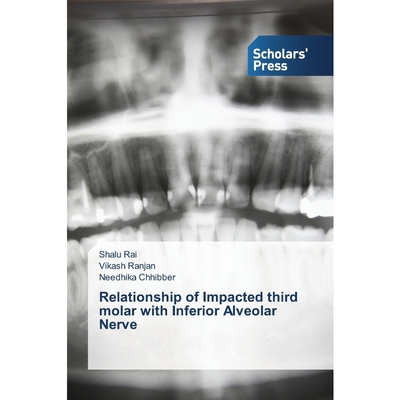 按需印刷不退不换Relationship of Impacted third molar with Inferior Alveolar Nerve[9783639767285]