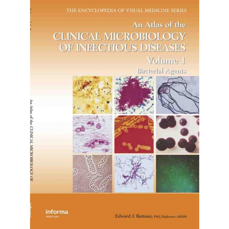 按需印刷TF An Atlas of the Clinical Microbiology of Infectious Diseases, Volume 1[9781842142196]