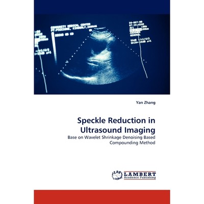 按需印刷Speckle Reduction in Ultrasound Imaging[9783838397597]