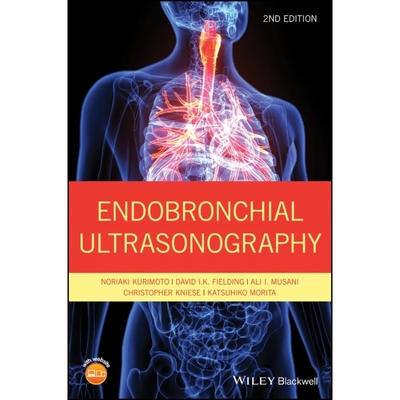 按需印刷Endobronchial Ultrasonography 2e[9781119233947]
