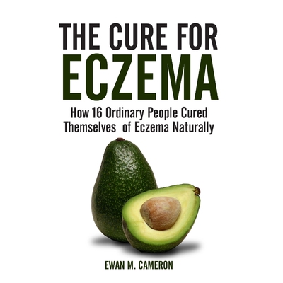 按需印刷The Cure for Eczema[9781785550393]