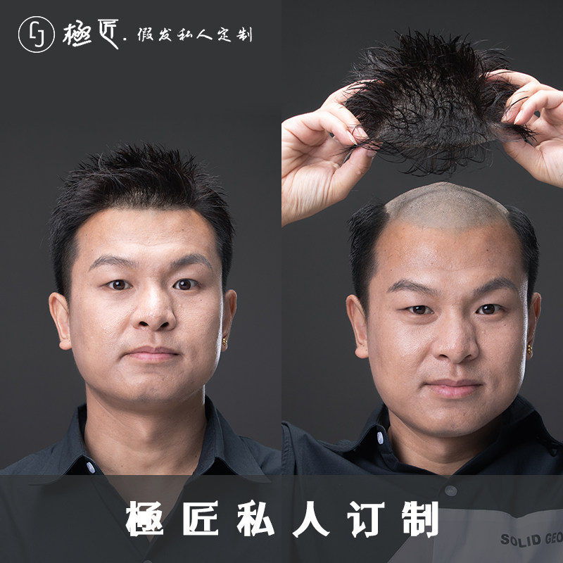 極匠假发量身定制新隐形无痕纳米皮肤生物头皮递针V针整顶假发