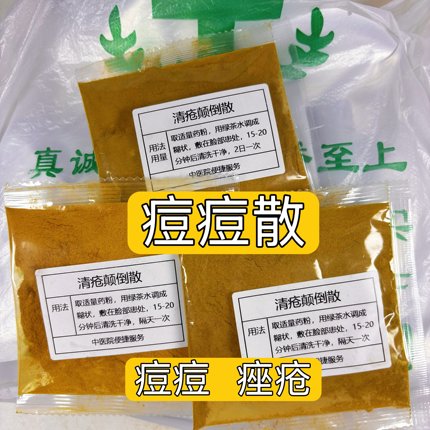 杭州医院【清疮痘散】 痘痘 痤疮 涂抹面膜