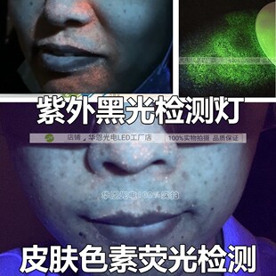紫外黑光检测灯 皮肤色素UV荧光 美容院脸毒素暗斑油脂黑头皮炎