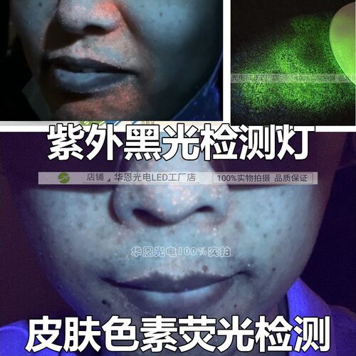 皮肤色素暗斑黑光检测护肤美容院
