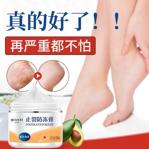 足跟脱皮价格 足跟脱皮图片 星期三