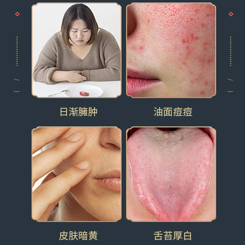 大肚腩塑形贴香港大药房无湿轻燃脂甩脂艾草吸油膏艾灸贴爆款