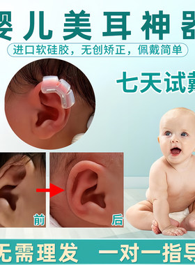 新生儿耳畸形定型塑形耳夹
