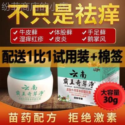 癣1大的夫 正品 软膏秦1朗癣立1克肉毒素头皮癣专用软膏湿癣1净