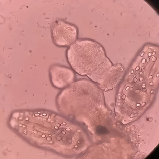原头蚴 棘球蚴 细粒棘球犬复孔莫尼茨绦虫虫卵成节孕节寄生虫装片