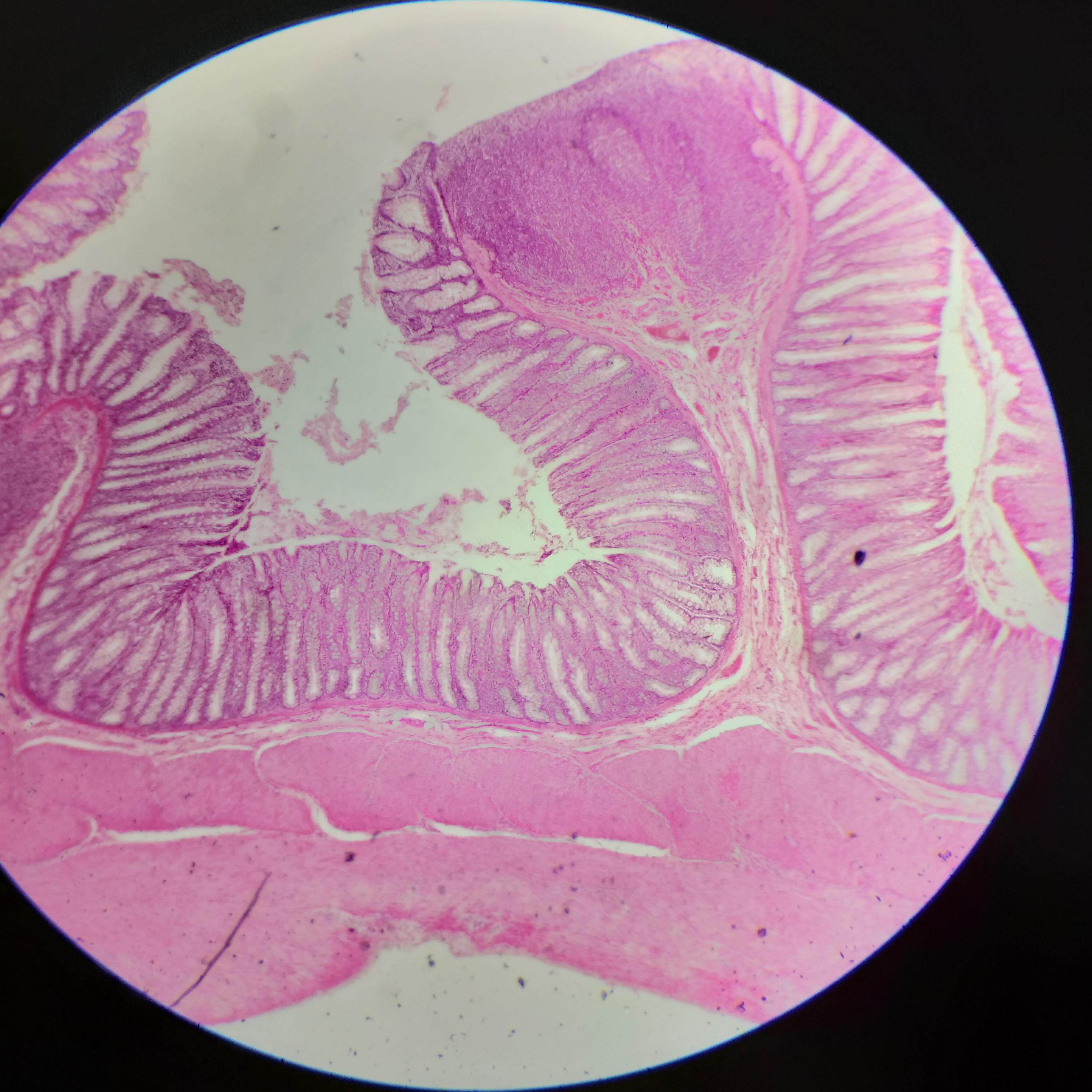 卓普高校医学院,基础医院学院教学标本组胚学玻片显微结肠切片