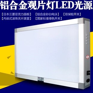 观片灯阅片灯LED观片灯箱铝合金看片灯箱TL观片灯X光观片灯箱骨科