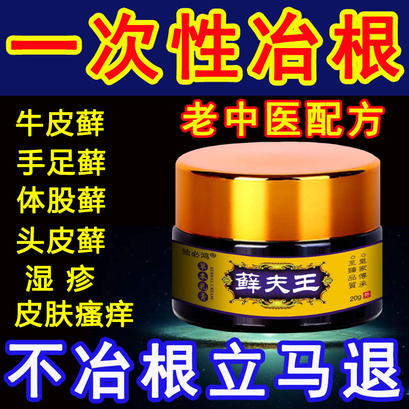 牛皮癬鲜银屑病股藓手足头皮癣皮炎水泡湿疹皮肤瘙痒止痒专用药膏