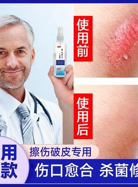 快速修复擦伤抓伤破皮伤口消炎杀菌修复伤口愈合促进长肉结痂喷雾