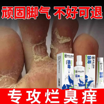 狼毒脚气喷剂喷雾臭烂脚丫脱皮糜烂脚趾缝烂痒脱皮杀菌止痒膏专yh