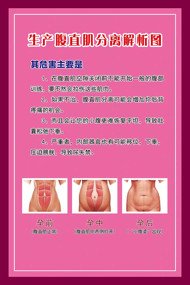 m769生产腹直肌分离解析图产护后修复中心墙贴画197展板海报印制