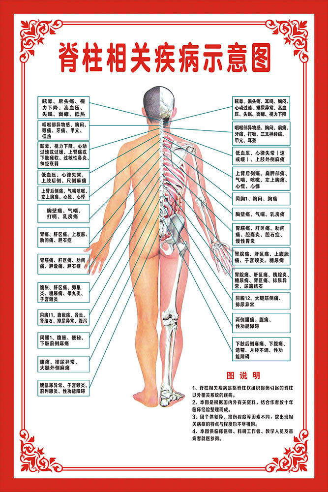 m769脊柱相关疾病示意图中医养生美容院贴画挂图1321展板海报印制