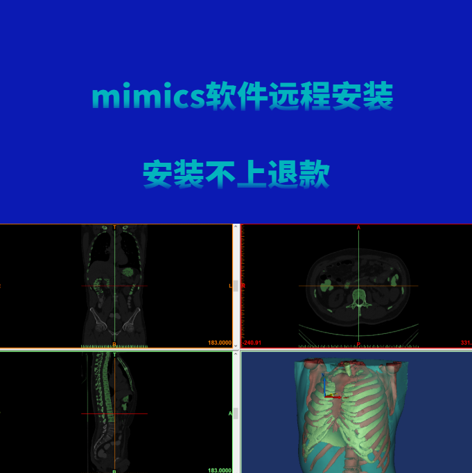 mimics16.0,19.0,20.0,21.