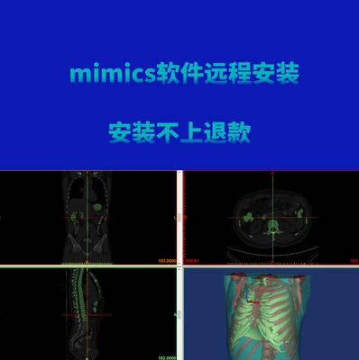 mimics16.0、19.0、20.0、21.0