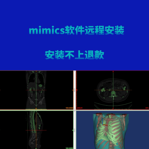 mimics16.0、19.0、20.0、21.0
