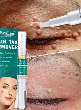 5ml Women Men Skin Tags Remover Painless Skin Dark Spot