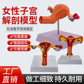 人体女性生殖子宫解剖病理模型 妇科生殖科教具 阴道卵巢教学模型