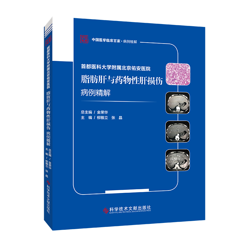 首都医科大学附属北京佑安医院脂肪肝与药物性肝损伤病例精解