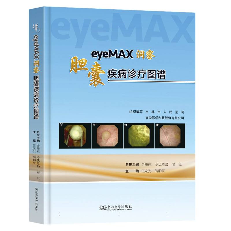 eyeMAX洞察 : 胆囊疾病诊疗图谱