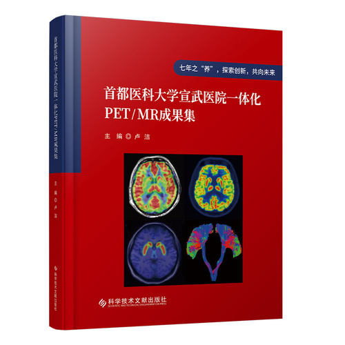 首都医科大学宣武医院一体化PET/MR成果集