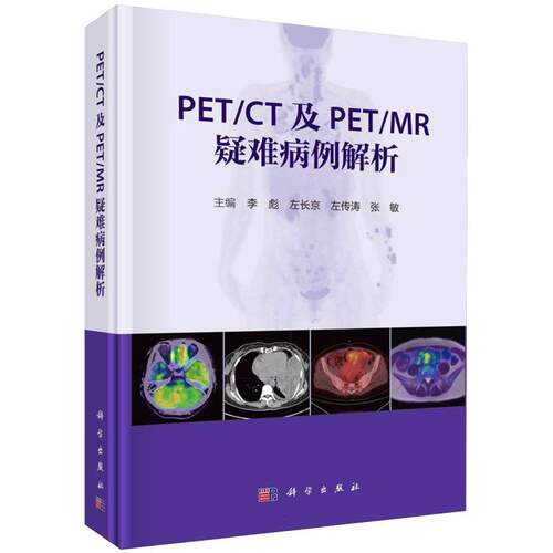 PET\CT及PET\MR疑难病例解析