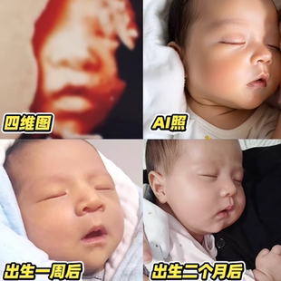 四维彩超宝宝照片ai智能生成胎儿未来长相预测孕妇产检三维还原