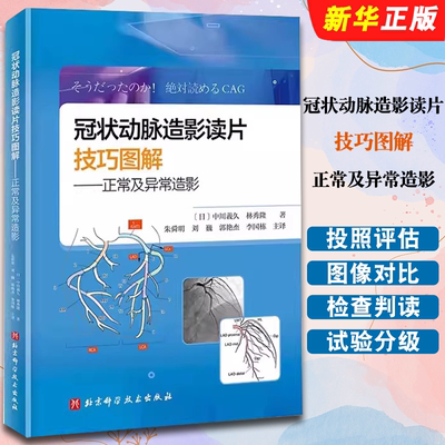冠状动脉造影读片技巧图解