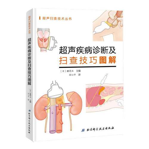 超声疾病诊断及扫查技巧图解種村正北京科学技术出版社