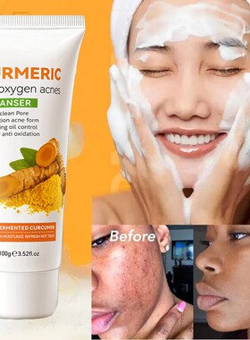 turmeric face cleanser wash gel blackhead acne spot洗面奶乳