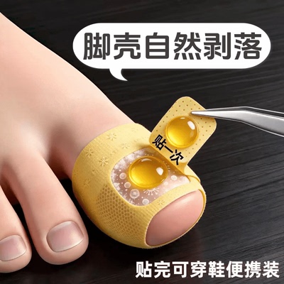 【国药热销】专用净甲除指甲贴植物萃取正品脚趾手指甲通用