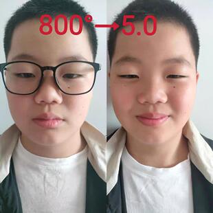 【小红书推荐】呵护双眼 叶黄素缓解 青少年护眼精华眼贴老少通用