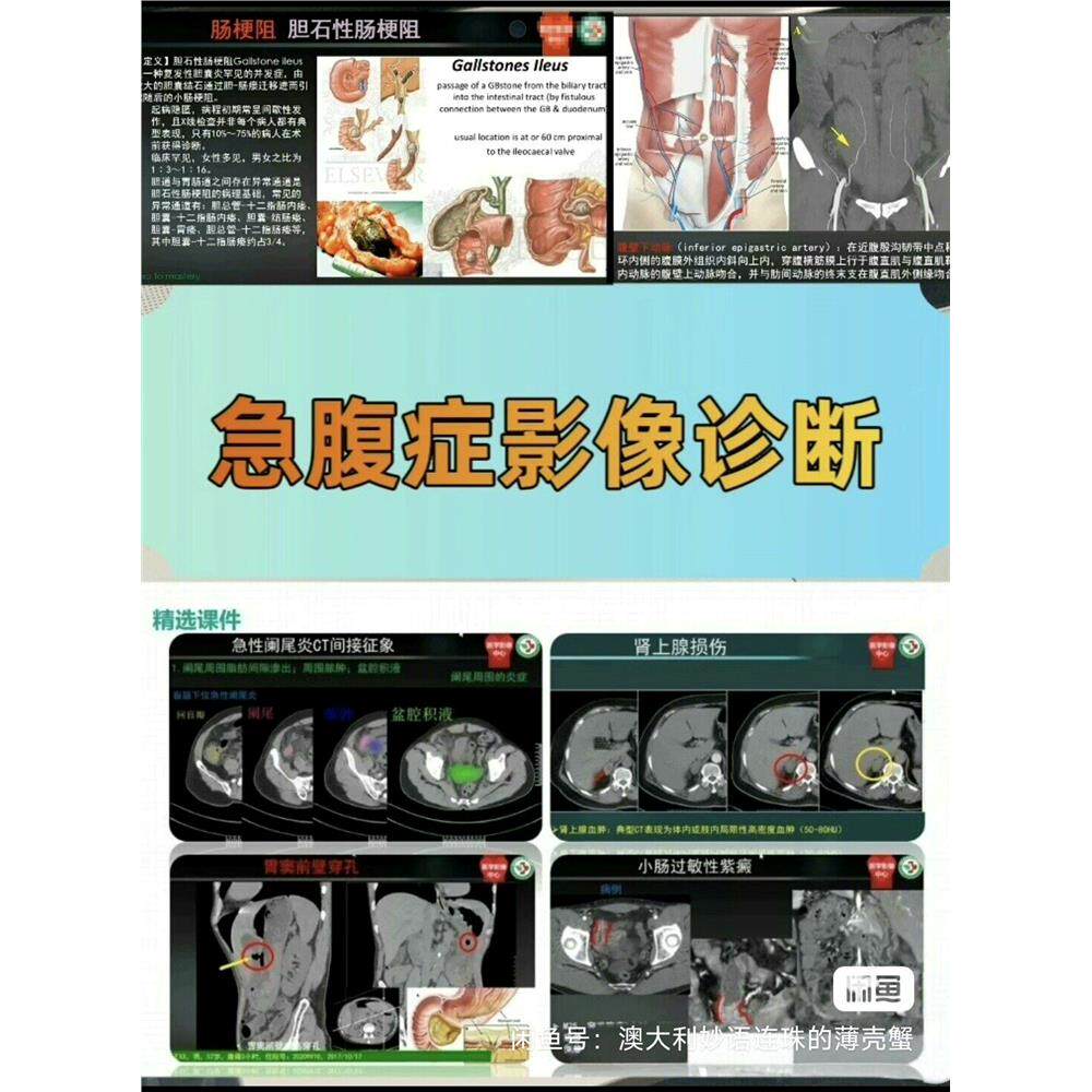 急腹症影像诊断学 ｜急诊夜班必备