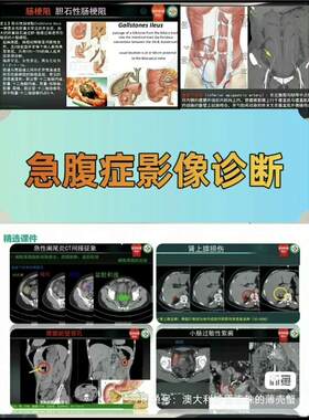 急腹症影像诊断学 ｜急诊夜班必备