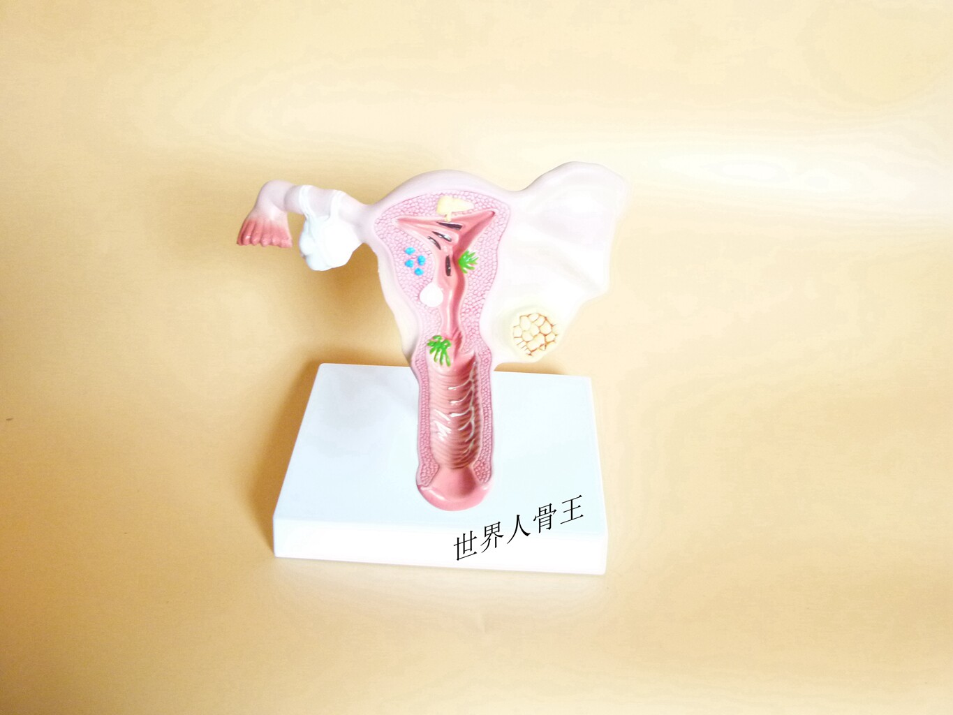 病理子宫模型 病变子宫演示 阴