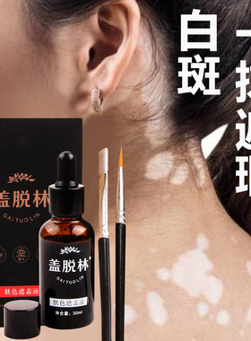 白斑肤色持久遮盖液笔