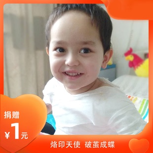 【慈善募捐】烙印天使 救助烧烫伤儿童 阿里公益宝贝 爱心捐款